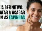 como acabar com as espinhas guia completo ativos e protocolo