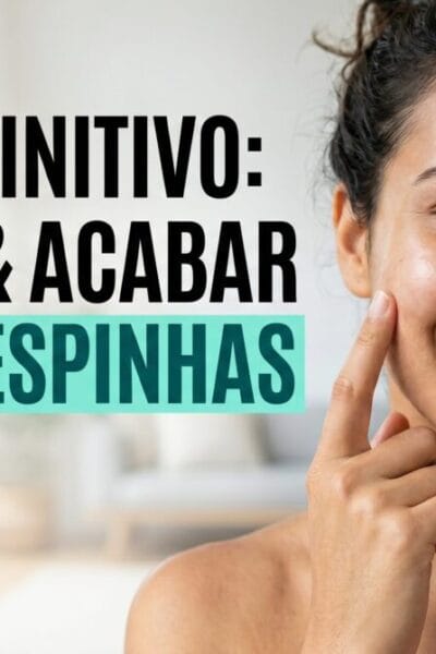 como acabar com as espinhas guia completo ativos e protocolo