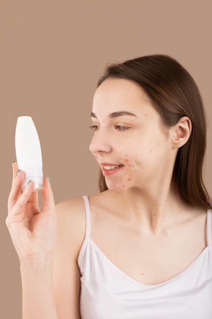 Manchas por acne pós-inflamatória: somem sozinhas?