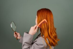alopecia feminina