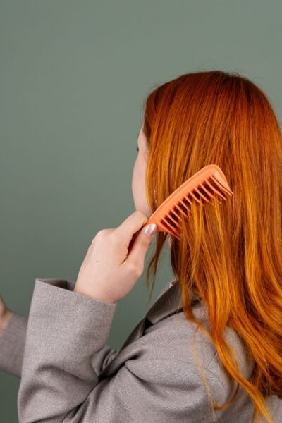 alopecia feminina