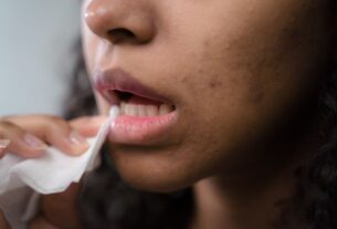 Darrow lança Actine Care para peles sensibilizadas pela acne